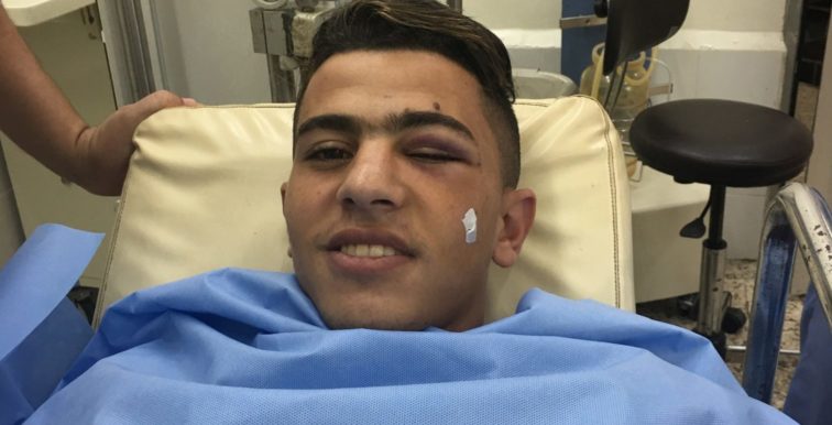 EN : opération réussie pour Attal